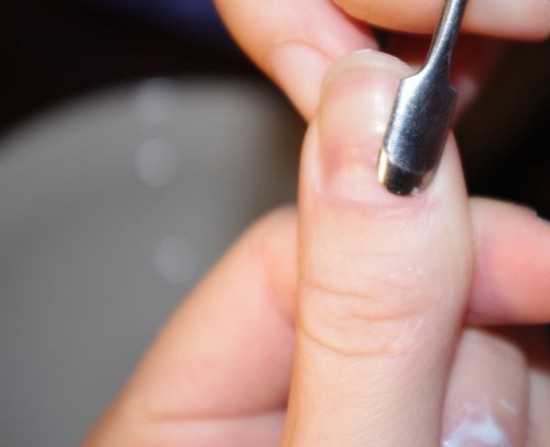 Cuticle fjerning