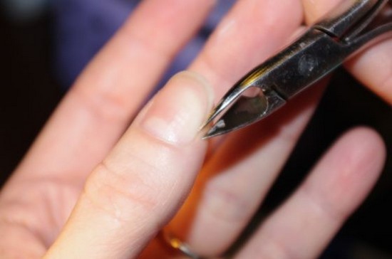 Cuticle fjerning