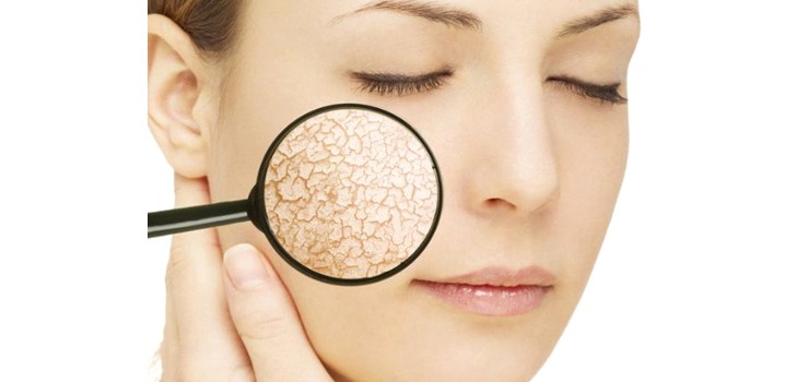 Oljer, masker og kremer for tørr hud