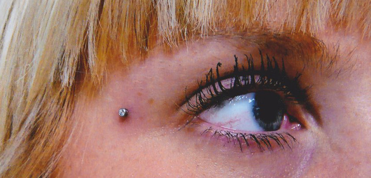 Microdermal piercing: hvordan microdermabras er laget (bilde)