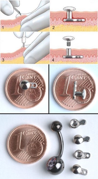 Microdermal piercing: hvordan microdermabras er laget (bilde)