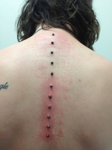 Microdermal piercing: hvordan microdermabras er laget (bilde)
