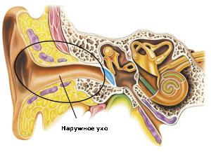 Hvordan behandle otitis i hjemmet?