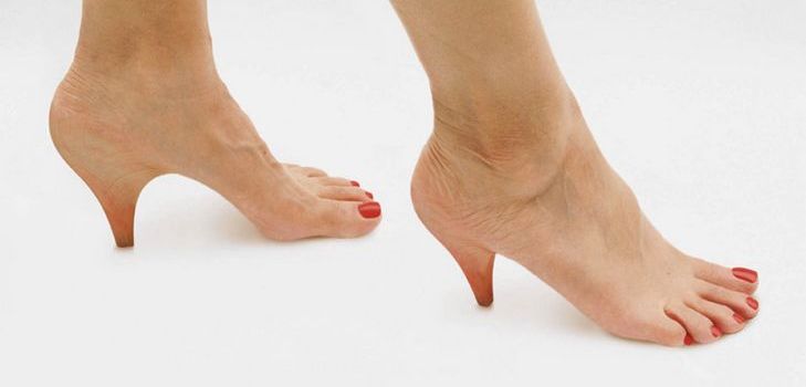Heel spurs: behandling med folkemessige rettsmidler