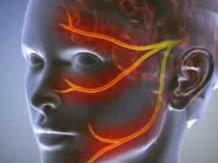 Neuralgi: symptomer, bilder, behandling