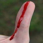Førstehjelp for blødning Førstehjelp for blødning