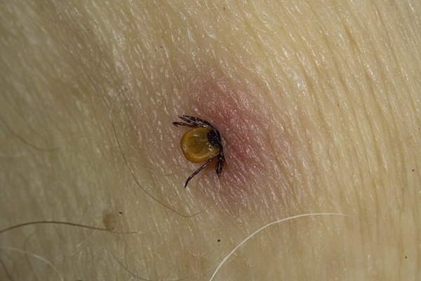 Insektbiter